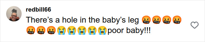 Comment on social media post expressing sympathy for toddler injured by pit bull attack on busy Manhattan street.