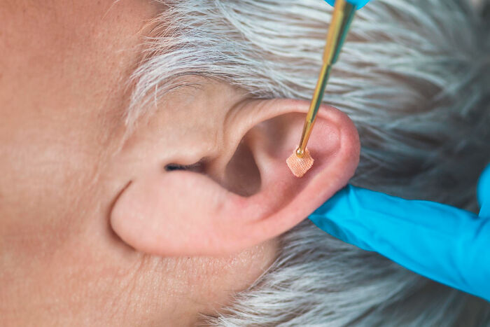 Close-up of a human ear showing unique body features being examined with a medical tool by a gloved hand.