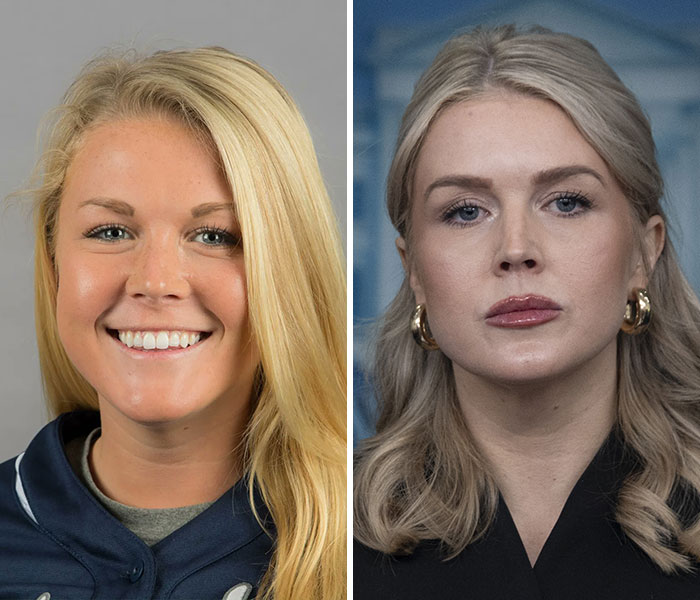 Close-up images of Karoline Leavitt with focus on alleged lip filler marks and photographer's defense.