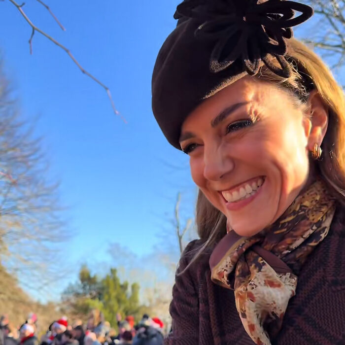 Kate Middleton smiling outdoors wearing a brown hat and scarf with visible facial scar in natural light. Kate Middleton smiling outdoors wearing a brown hat and scarf with visible facial scar in natural light.