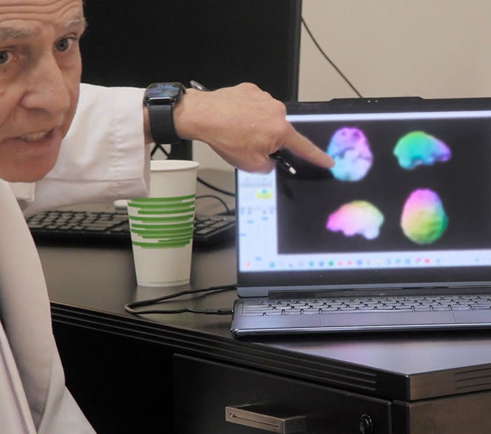 Doctor pointing at colorful brain activity scans on a laptop screen discussing low brain activity results. Doctor pointing at colorful brain activity scans on a laptop screen discussing low brain activity results.