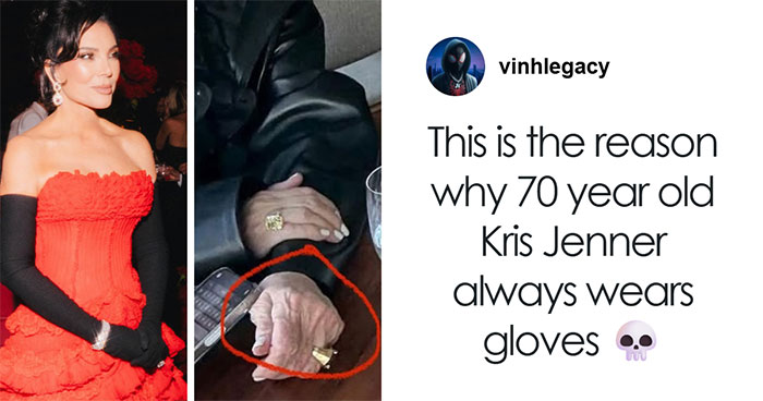 The Internet Is Divided After Kris Jenner Finally Exposes Her Hands Publicly After Viral Facelift