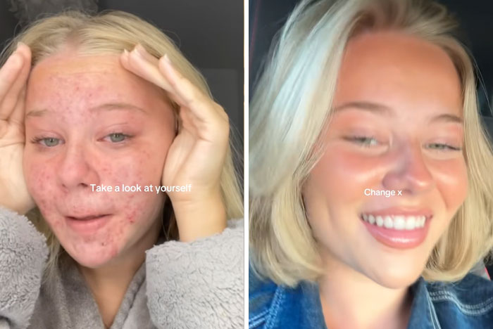 Young woman showing her glow-up transformation with clear skin and a bright smile in a Man In The Mirror video.