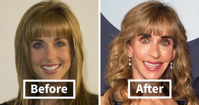 10 “Mar-a-Lago” Face Transformations That Left People Utterly Stunned
