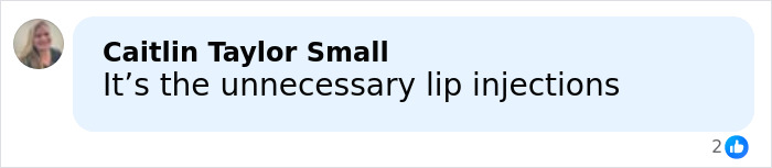 Comment by Caitlin Taylor Small saying its the unnecessary lip injections discussing Millie Bobby Brown plastic surgery rumors.