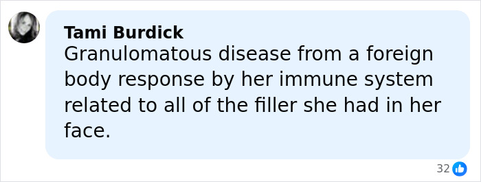 Comment by Tami Burdick explaining granulomatous disease linked to facial filler causing immune response and disfigurement.