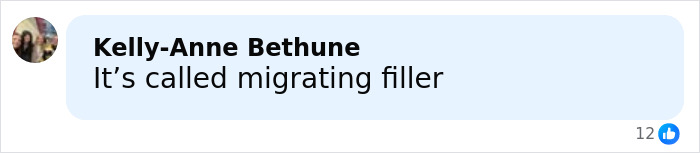 Comment by Kelly-Anne Bethune saying it&rsquo;s called migrating filler on a light blue background with a small user profile image.