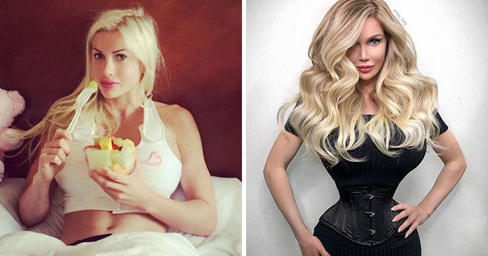 Before and after images of a blonde woman showing changes related to plastic surgery and celebrity experiences.