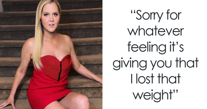 “No Mystery”: Amy Schumer Sets The Record Straight On Her Health And Cosmetic Procedures