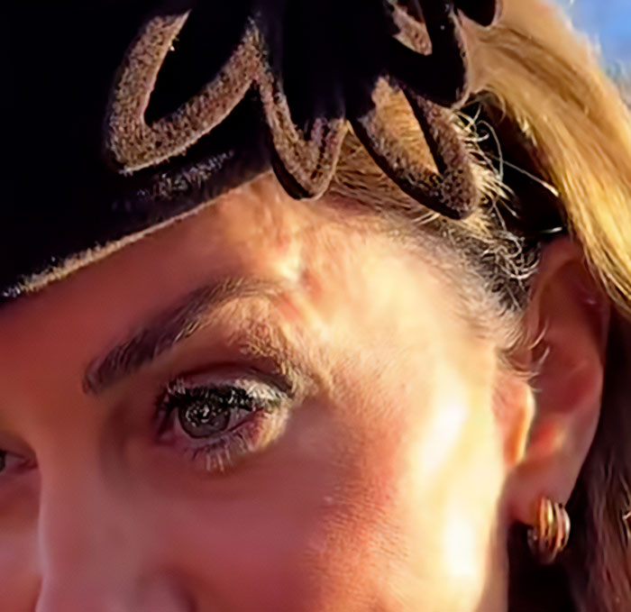 Close-up of Kate Middleton's face showing a skin mark during Christmas appearance fueling cancer scar conspiracy theories.