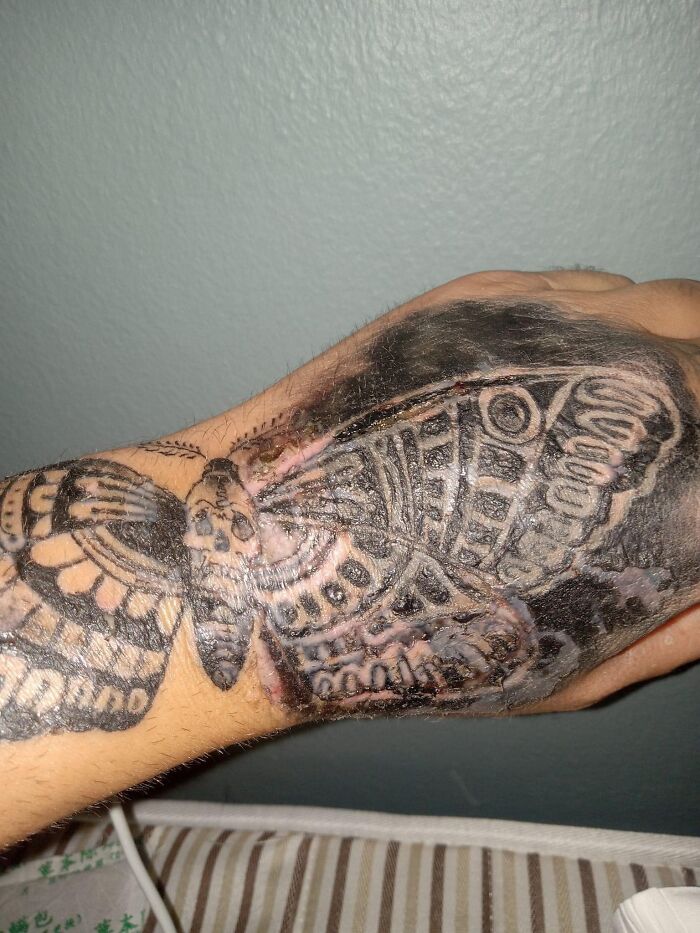 Close-up of a poorly done butterfly tattoo on a hand, showing signs of fading and scarring, in a worst tattoos group.