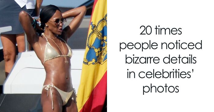 “Winner Of The Worst Photo Edit”: 20 Times Fans Noticed Bizarre Details In Celebrity Photos
