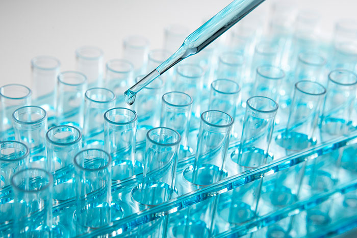 Close-up of a pipette dropping liquid into test tubes, representing DNA tests revealing shocking family information.