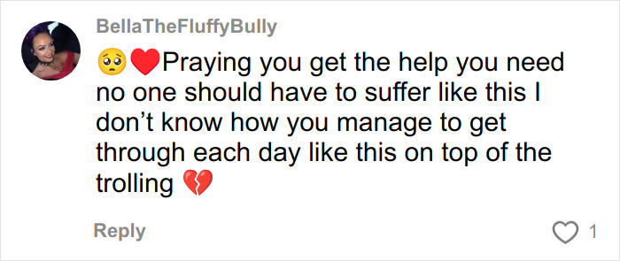 Comment expressing sympathy and support for woman who got veneers in Turkey and experienced nose collapse. Comment expressing sympathy and support for woman who got veneers in Turkey and experienced nose collapse.