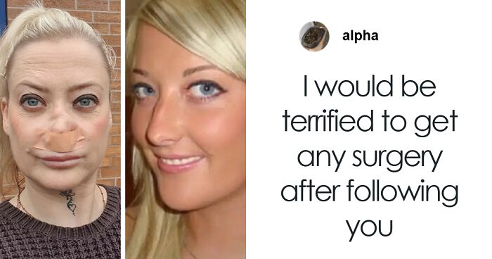 “My Face Is Changing Every Day!”: Woman’s $4k ‘Turkey Teeth’ Procedure Goes Horribly Wrong
