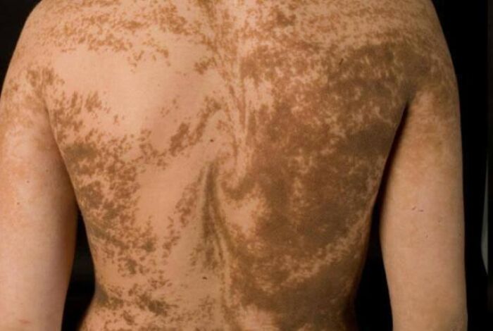 "Vatican City Has The Highest Crime Rate In The World": 49 Nonsense-Sounding Statements That Turned Out To Be True