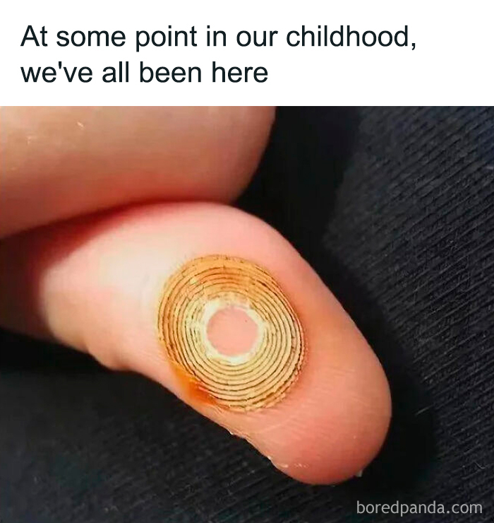 Close-up of a finger with a circular worn-down bandage, evoking nostalgic childhood memories to make you feel old.