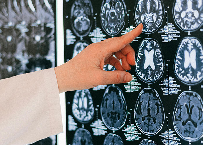 Hand of medical professional pointing at brain scan images on a screen related to worst things said to patients.