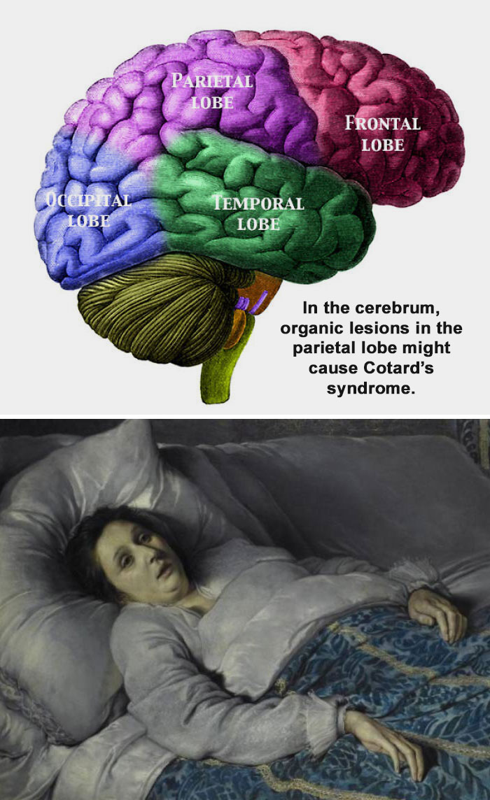 46 Medical Facts So Unusual Most People Never Learn Them