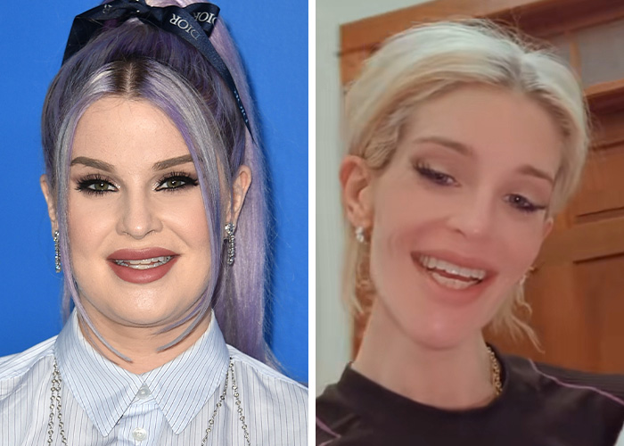 Side-by-side images of two women with contrasting facial appearances highlighting the extremely skinny look trend in Hollywood faces.