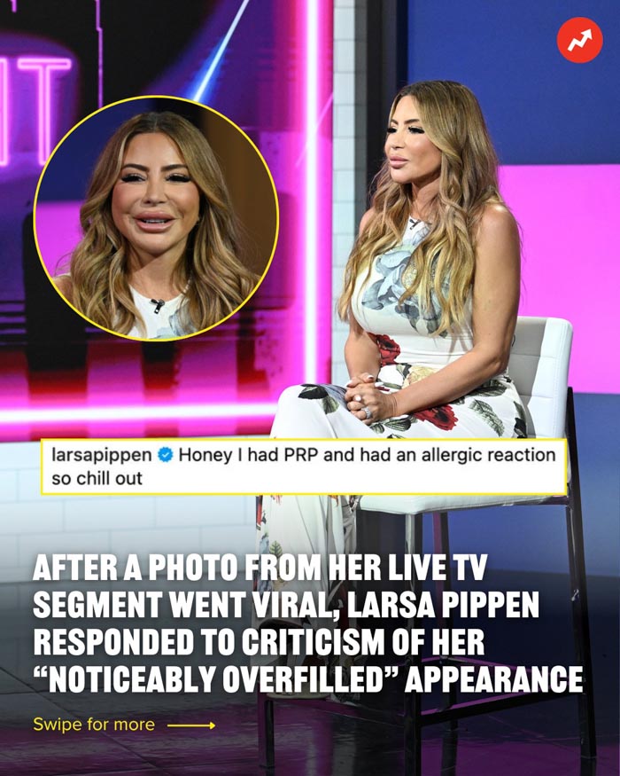 Larsa Pippen plastic surgery transformation showing her noticeably overfilled lips and facial changes during a TV interview.