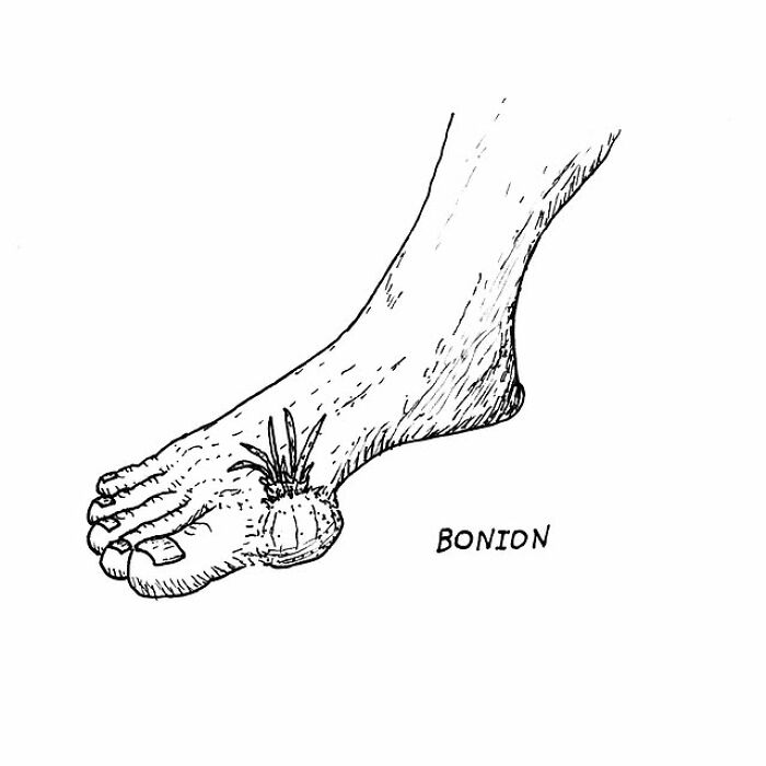 Black and white drawing of a foot with a small onion growing on the big toe, a visual pun by the artist.
