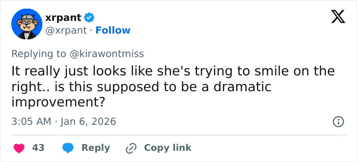 Plastic Surgeon Goes Viral After Dry Response To Facelift Critic Leaves Internet Laughing Hard