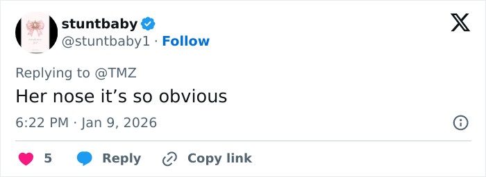 "Hand Her A Mirror": Kendall Jenner Draws Scrutiny After Denying Plastic Surgery Rumors "Hand Her A Mirror": Kendall Jenner Draws Scrutiny After Denying Plastic Surgery Rumors