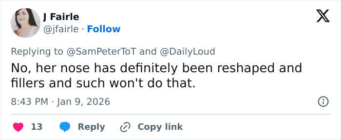 "Hand Her A Mirror": Kendall Jenner Draws Scrutiny After Denying Plastic Surgery Rumors "Hand Her A Mirror": Kendall Jenner Draws Scrutiny After Denying Plastic Surgery Rumors