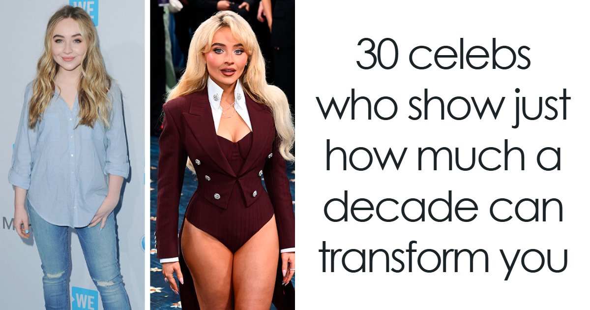 “What’s With The Cadaver Look?”: 30 Celebs Who Show Just How Much A ...
