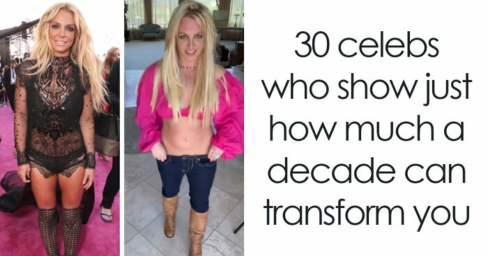 “What’s With The Cadaver Look?”: 30 Celebs Who Show Just How Much A Decade Can Transform You