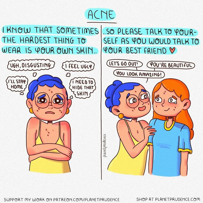 Comic by Planet Prudence illustrating acne struggles and self-kindness, highlighting what being a woman is like.