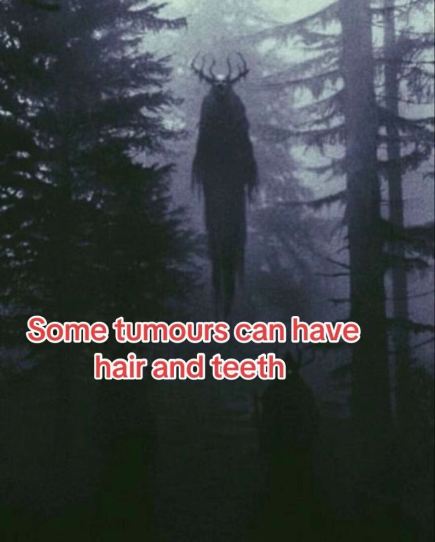 Dark forest scene with a shadowy figure and text about scary tumors having hair and teeth, bone-related scary facts.