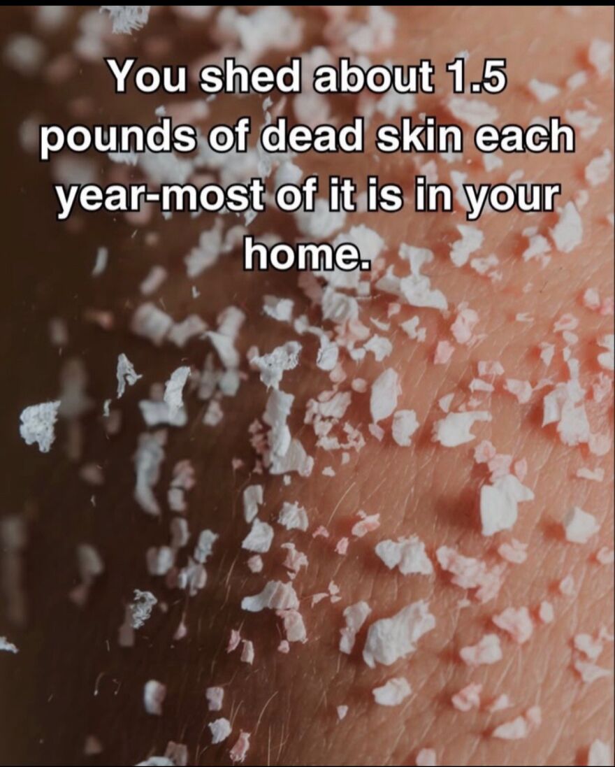 Close-up of dead skin flakes on human skin illustrating a scary fact related to bones and skin shedding.