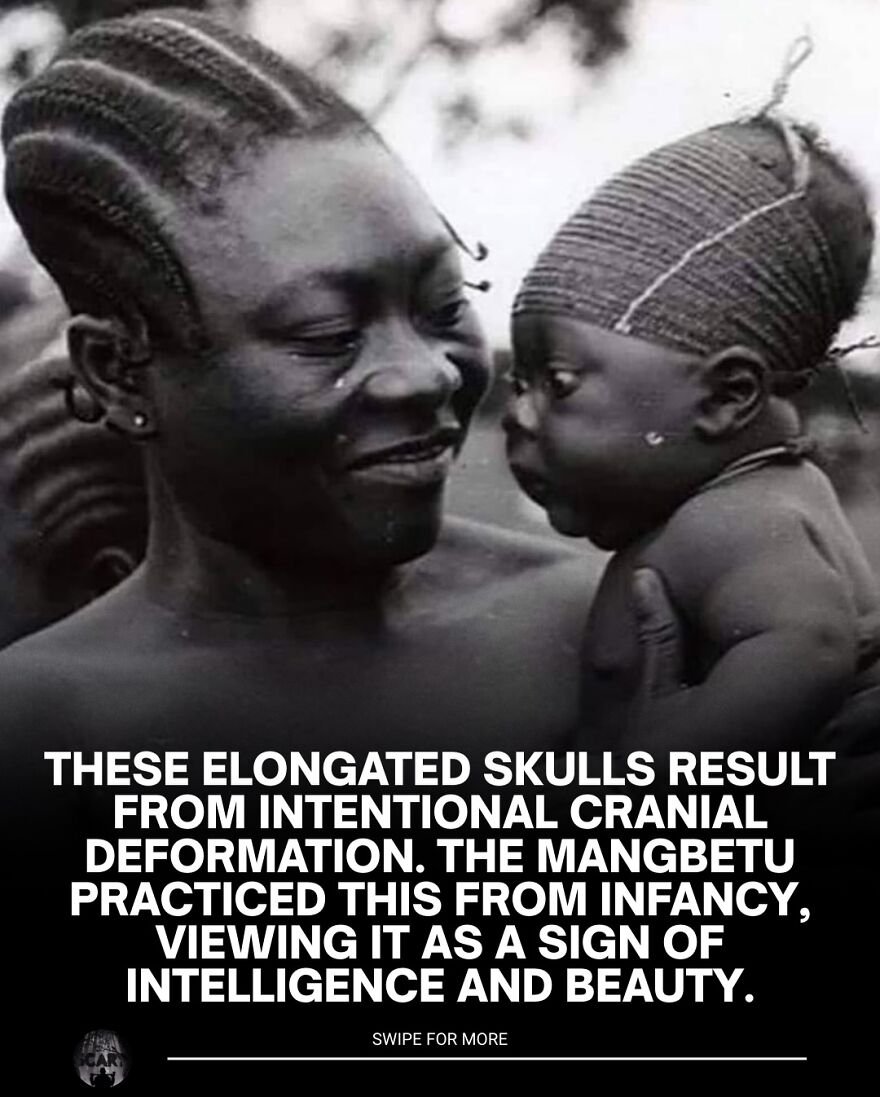 Black and white photo showing intentional cranial deformation practiced by Mangbetu, relating to scary bones facts for sleep loss.
