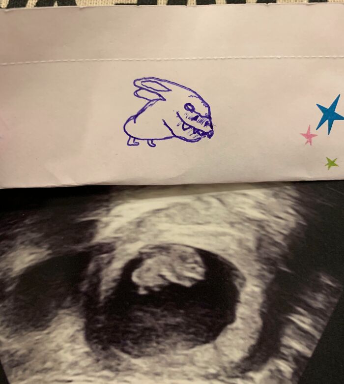 Ultrasound photo of a baby with a whimsical blue ink drawing on an envelope, highlighting sibling fun moments.