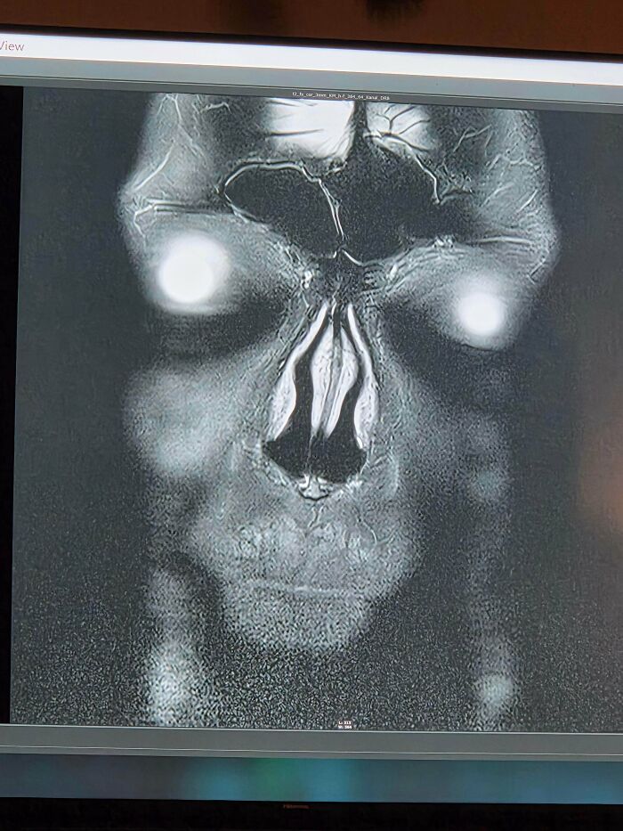 MRI scan resembling a skull face with glowing eyes, one of the scariest posts shared online.