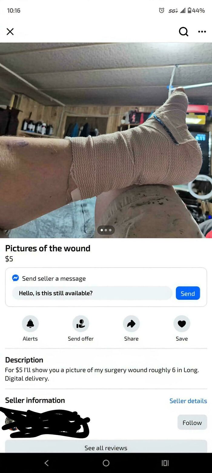 Unhinged things for sale online, bandaged foot photo used in listing selling pictures of a wound