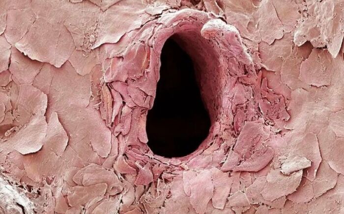 Primer plano de una imagen médica fascinante y ligeramente inquietante mostrando detalles inusuales de tejido humano.