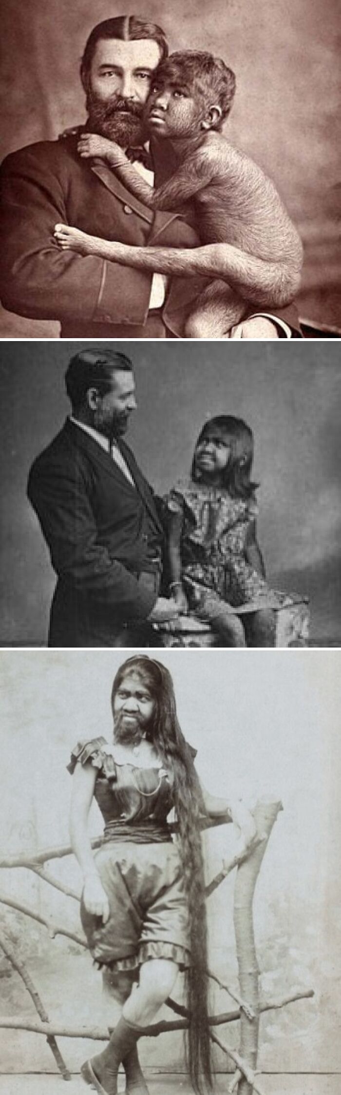 Victorian era photos showing a man holding a hairy child, a man with a bearded girl, and a woman with long hair and facial hair.
