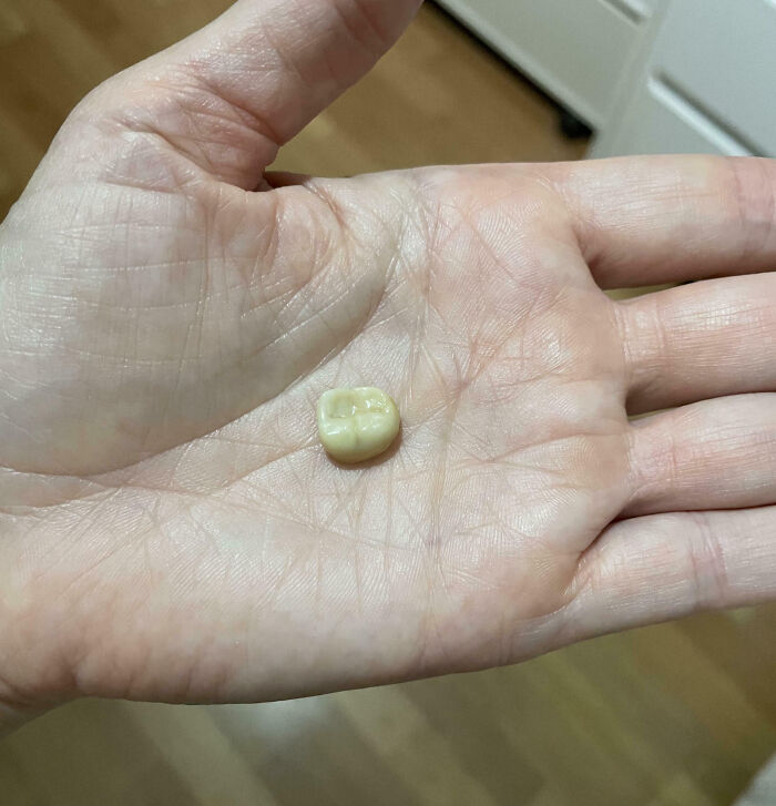 A close-up of a hand holding a dental crown, illustrating an unfortunate and expensive fail.