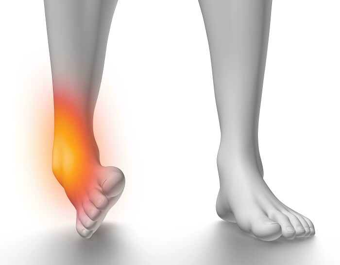 3D illustration of a foot pain area highlighted in orange representing life with a spicy neurodivergent brain experience