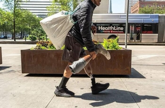 Man with a prosthetic leg walking on a city street, capturing life's unexpected and beautiful moments in a street photo.