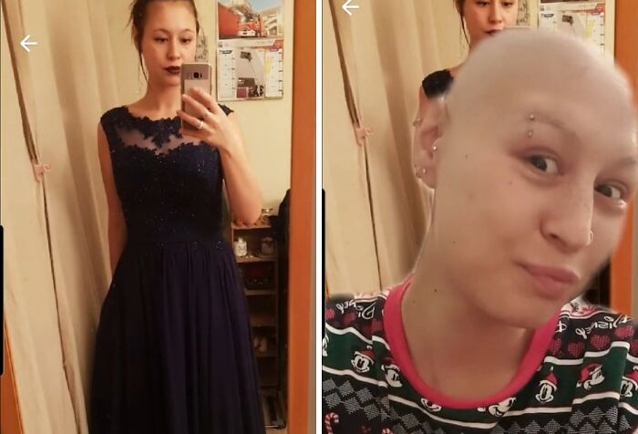 Side-by-side photos showing a woman before and after a glow down, illustrating vulnerability and personal transformation.