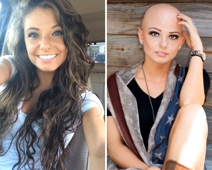 Before and after glow down transformation showing vulnerability and change in appearance over time.