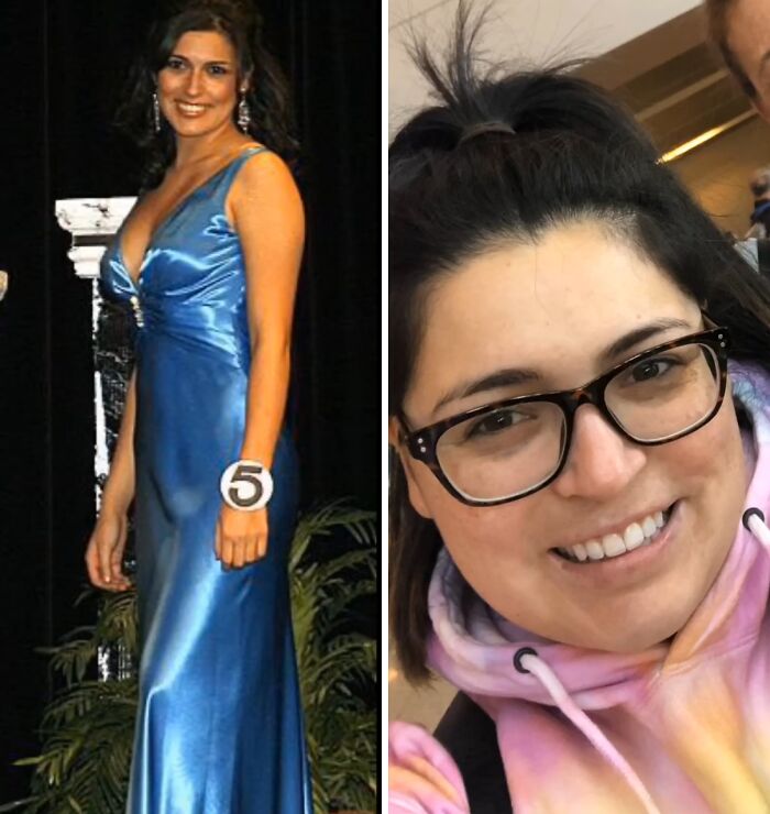 Side-by-side photos showing a woman’s glow down transformation highlighting how people have changed since they peaked.