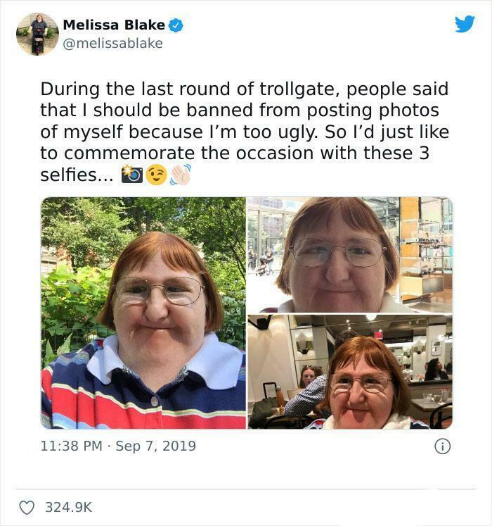Amazing photos: Melissa Blake's selfies to brighten your day.