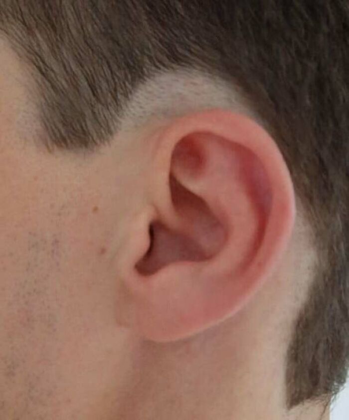 A close-up of an ear with a faded temple and an unfortunate haircut.