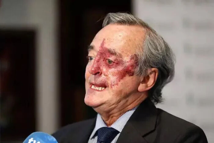 An amazing photo of a man with a severe facial injury. This picture might brighten your day.