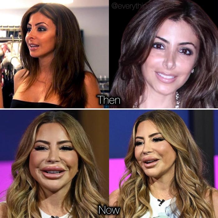Larsa Pippen plastic surgery transformation showing changes in facial features and appearance over time.